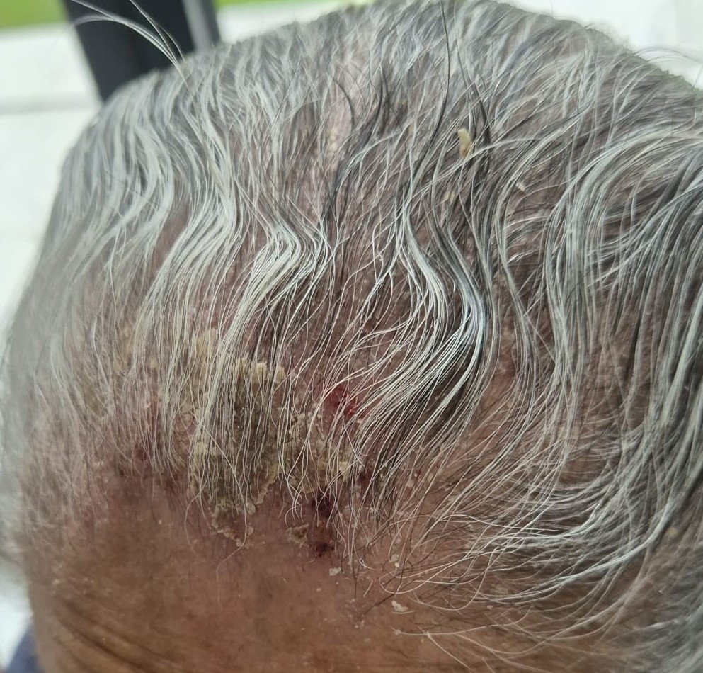 Before Hair & Scalp Problems